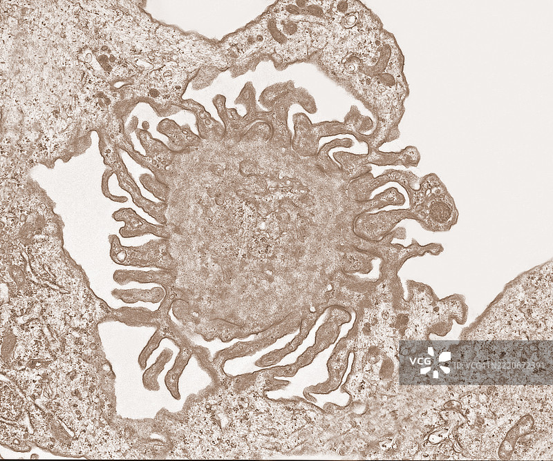 肾小球中足细胞足突的电子显微镜图像图片素材