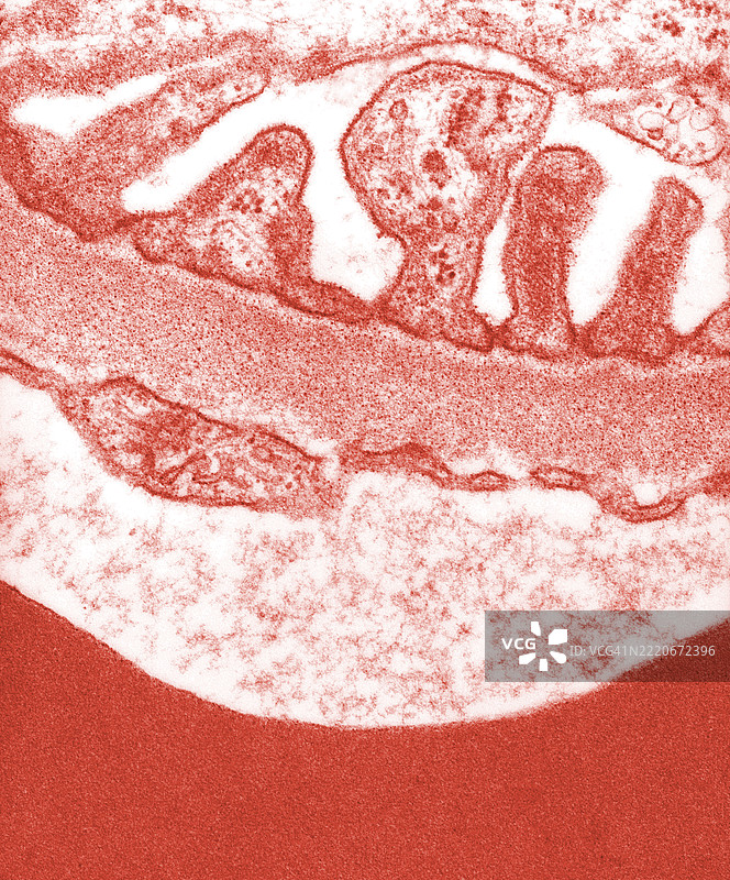 肾小球基膜的电子显微镜图像图片素材