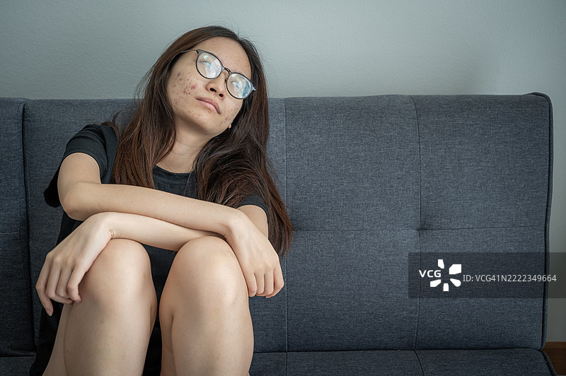 一位悲伤哭泣的女性肖像，她的朋友们在谈论她脸上的发炎痤疮时对她进行骚扰和欺凌。图片素材
