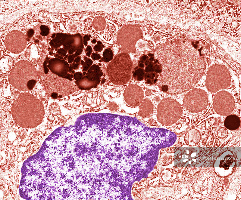 单个巨噬细胞的溶酶体图片素材