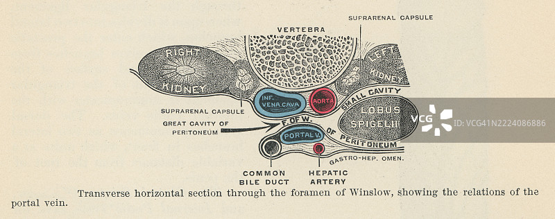 老式雕刻插图，展示了温斯洛孔的横截面，肠系膜孔（腹部的一个自然开口，连接大腹膜腔和小囊），显示了门静脉的关系。图片素材