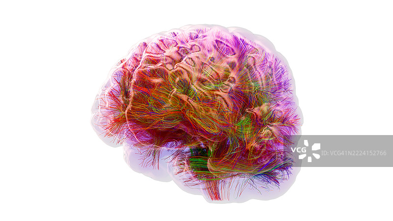 人脑纤维束图，插图图片素材