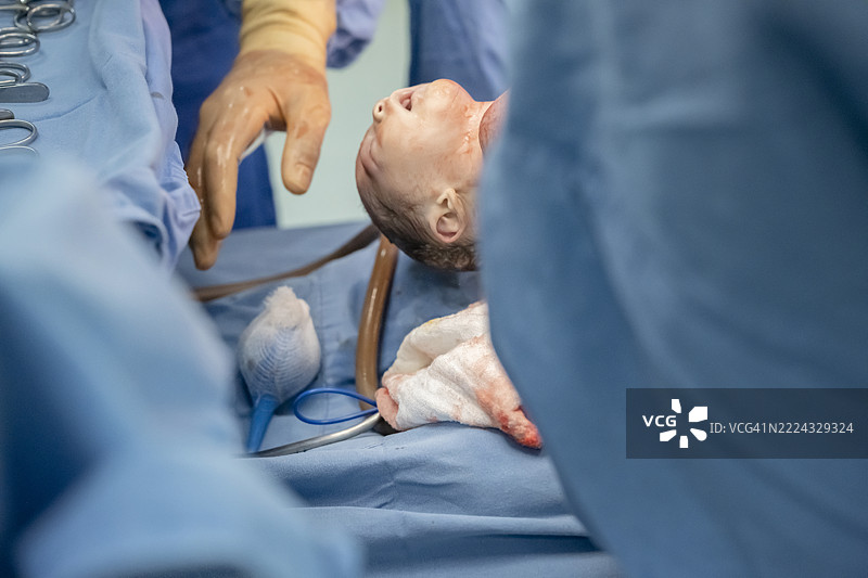 剖宫产过程中的医疗团队图片素材