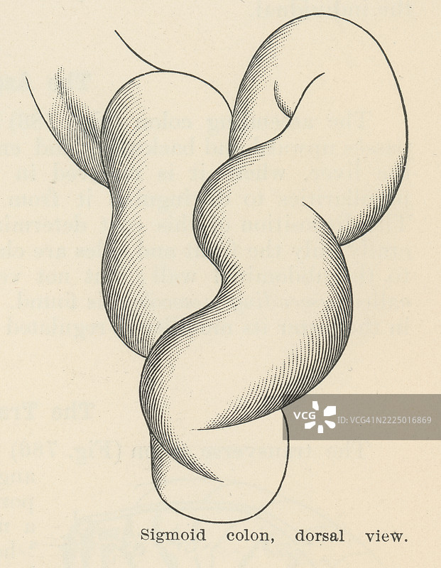 旧版雕刻插图显示了乙状结肠（大肠的一部分）的背面视图图片素材