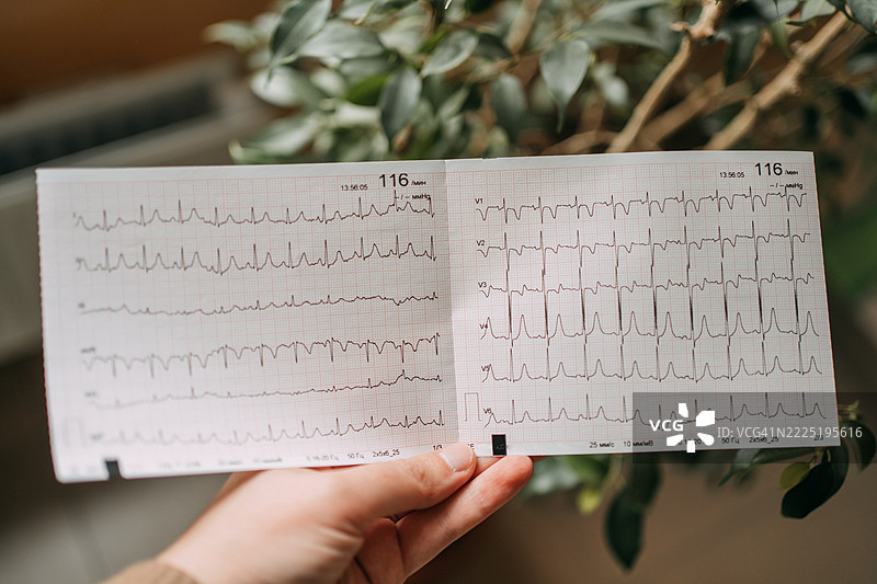 医生手持显示心率和心律的心电图结果图片素材