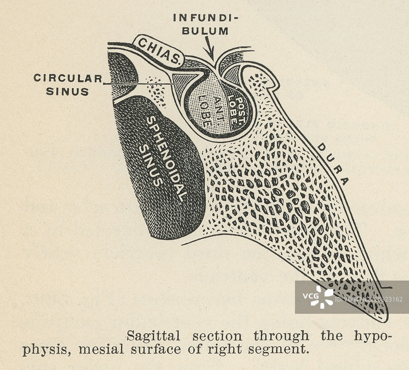 旧版雕刻插图，显示垂体或脑下垂体（内分泌腺）的矢状切面，右侧部分的内侧表面图片素材