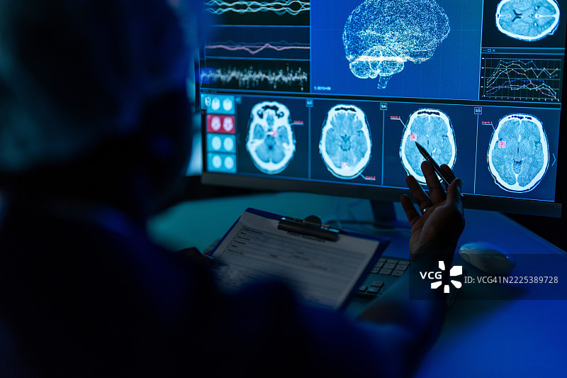 科学家在电脑上审查MRI医学扫描的结果图片素材