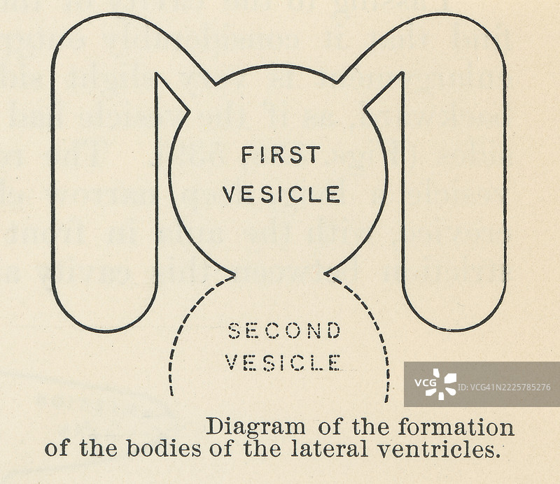 旧版雕刻插图的人体解剖 - 侧脑室形成的图解图片素材