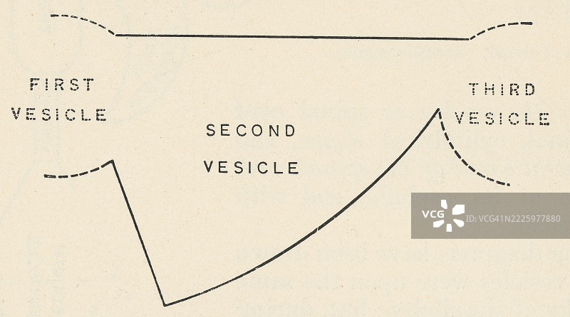 早期人类胚胎三囊泡阶段的古老雕刻插图图片素材