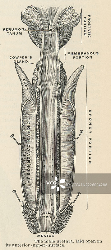 男性尿道的古老雕刻插图图片素材
