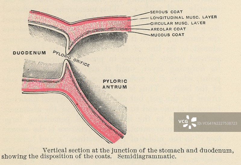 旧的彩色石版画插图，显示胃与十二指肠交界处的纵向剖面图图片素材