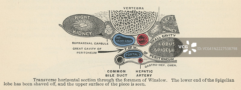 温斯洛孔或网膜孔的古老雕刻插图，连接大腹膜腔与小囊（网膜囊）的开口图片素材