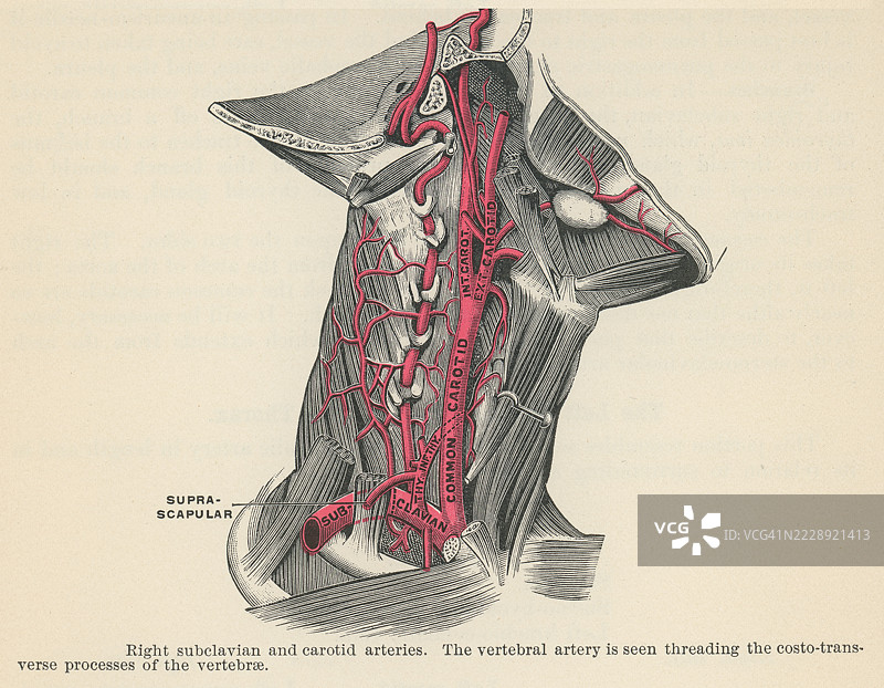 旧版雕刻插图显示右侧锁骨下动脉和颈动脉图片素材