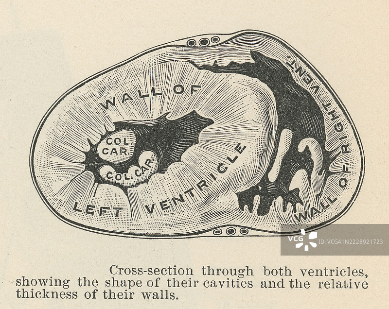 旧版雕刻插图，显示了两个心室的横截面解剖结构图片素材