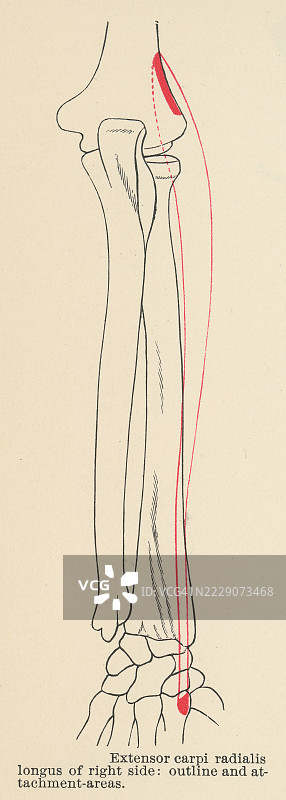 老式雕刻插图，展示人手肌肉 - 桡侧伸腕肌，这是控制手腕运动的五大主要肌肉之一图片素材
