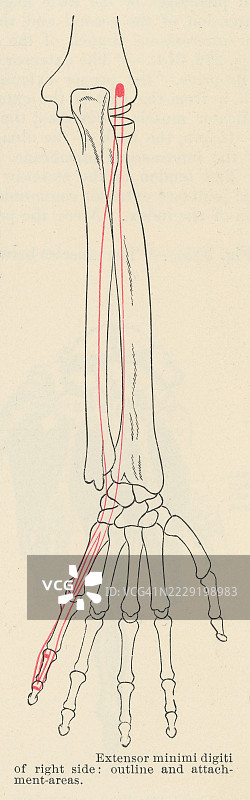老版雕刻插图，展示人手肌肉 - 小指伸肌（小指专用伸肌），是一条细长的前臂肌肉，位于共同伸肌的尺侧。图片素材