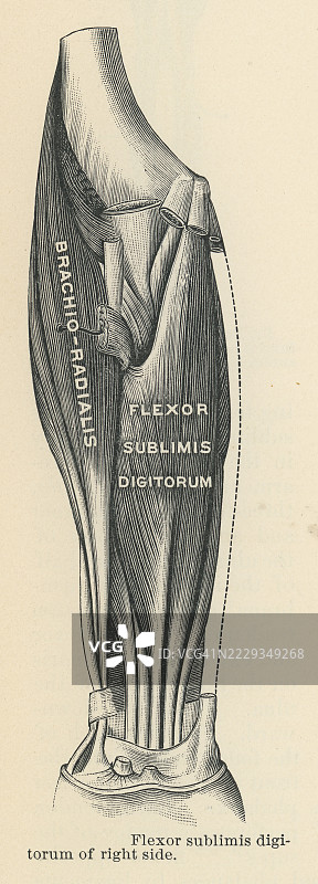 人手肌肉的旧版雕刻插图 - 浅指屈肌（或称为浅指屈肌或共同浅指屈肌），是手指在近端指间关节的外源性屈肌。图片素材