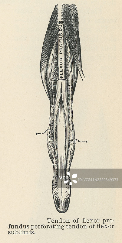 老式雕刻插图，展示人手肌肉 - 深屈肌，前臂中的一块深层肌肉，对手指的屈曲起着至关重要的作用。图片素材