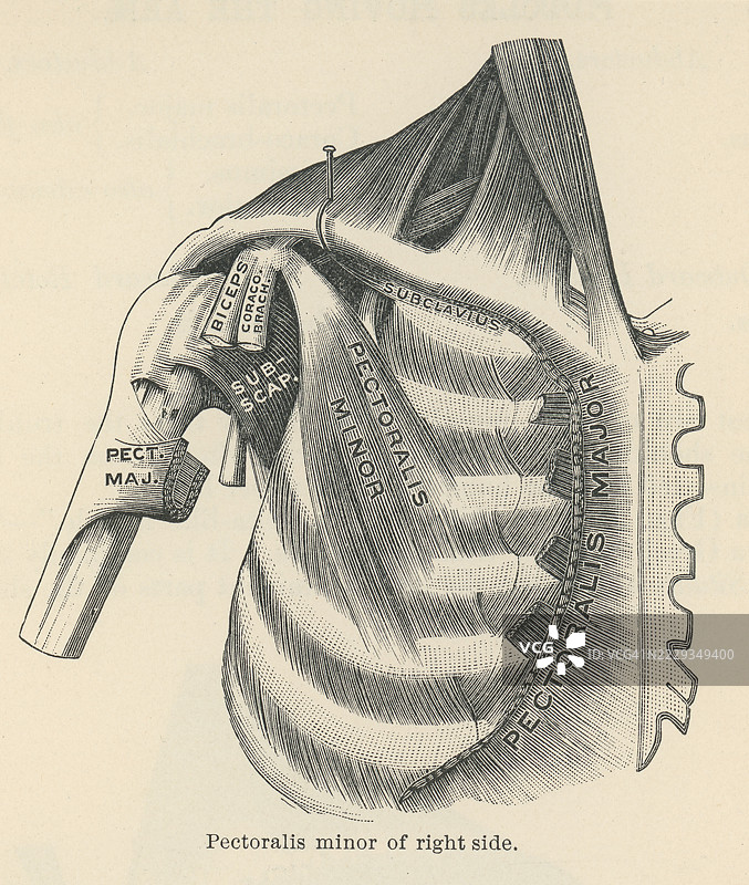 人手肌肉的旧版雕刻插图 - 小胸肌，一种薄而三角形的肌肉，位于胸部上部，位于人体的大 胸肌下方。图片素材