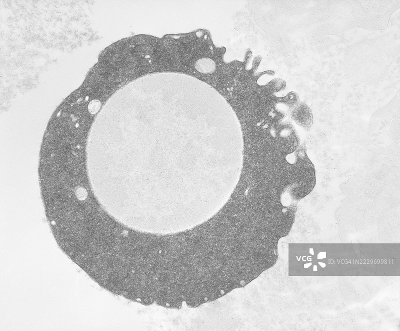 骨髓中未成熟红血球的DAB氧化染色图片素材