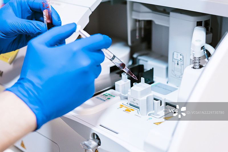 医生在实验室分析血样的手部特写图片素材