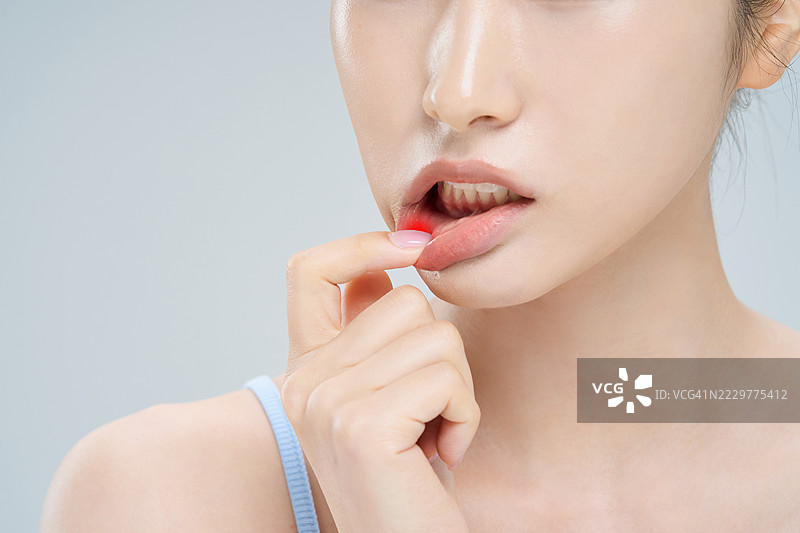 治疗、药物、疾病、疼痛、疾病、医疗保健、牙龈疾病、口腔健康图片素材