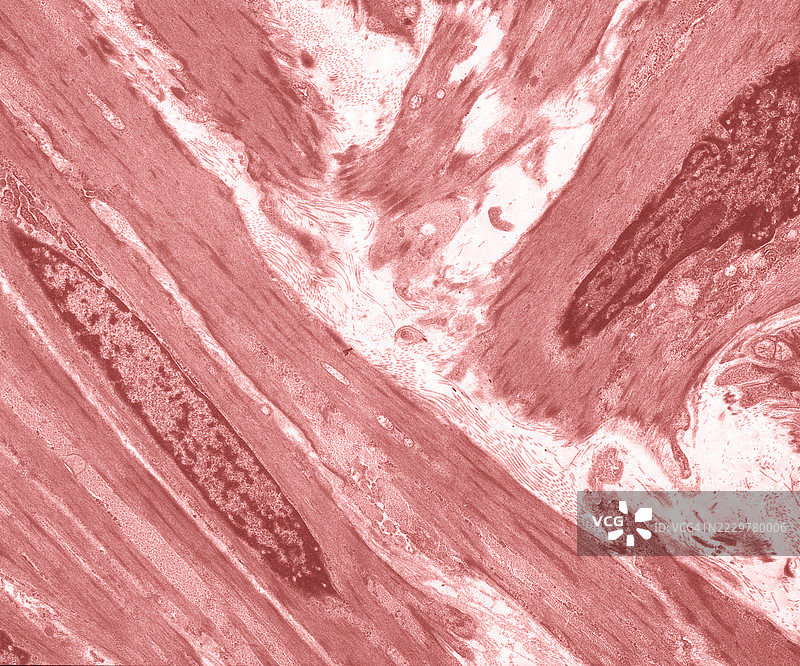 在平滑肌中，圆形的格子结构收缩肌肉图片素材