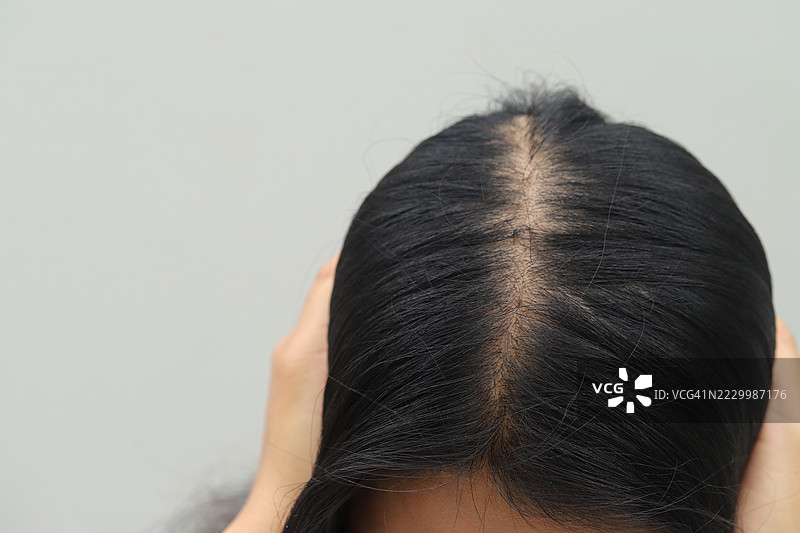 泰国曼谷的女性，面临脱发、干燥和毛躁问题。图片素材