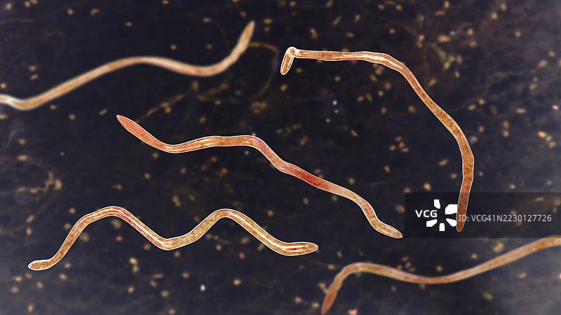 毛发弯曲螺旋菌插图图片素材