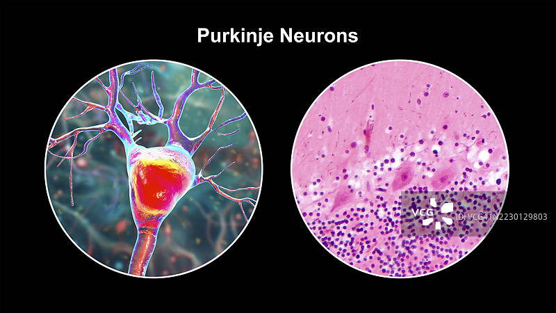 普金杰神经元和光学显微镜图，插图图片素材