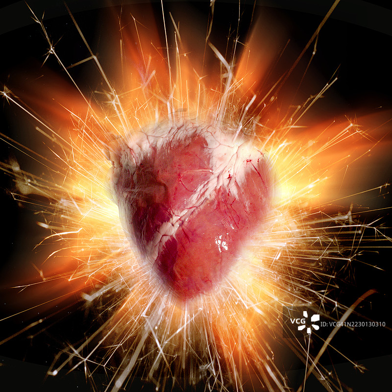 心脏问题，概念插图图片素材