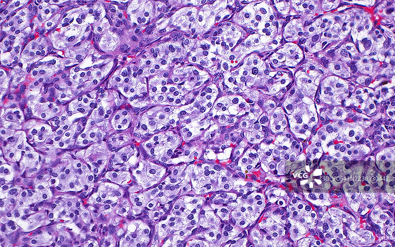 副神经节瘤，光学显微镜图像图片素材