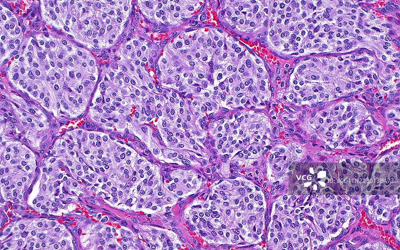 副神经节瘤，光学显微镜图像图片素材