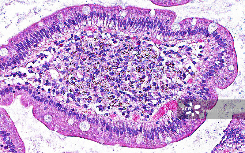 十二指肠中的镧沉积，光学显微镜图像图片素材