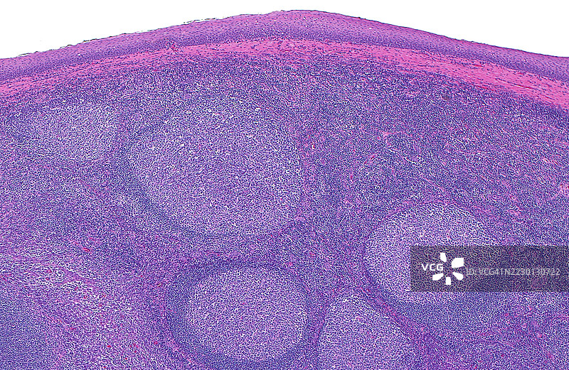 扁桃体，光学显微镜图像图片素材