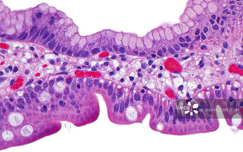 腺体上皮化生，光学显微镜图像图片素材
