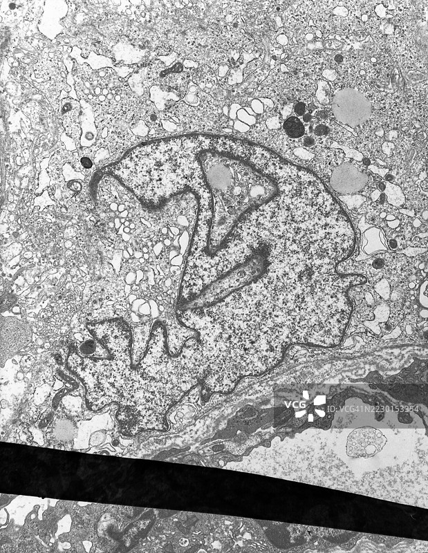 细胞内非常不规则的细胞核图片素材