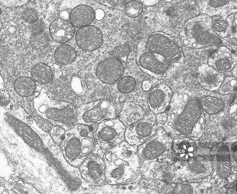 小脑突触部位神经递质和线粒体的电子显微镜图像图片素材
