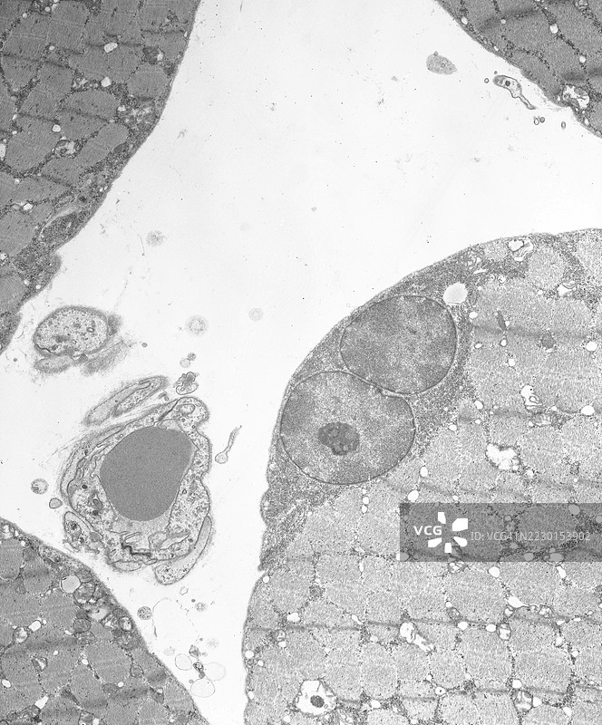 通过透射电子显微镜观察的糖原储存肌肉的代谢疾病图片素材