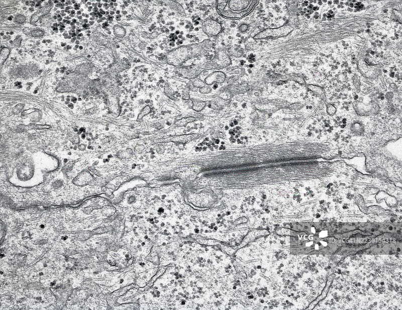 上皮细胞边界的细胞间连接电子显微镜图，放大30,000倍图片素材