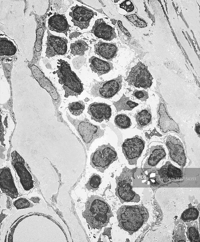 淋巴管内淋巴细胞的电子显微镜图像及周围的胶原束图片素材