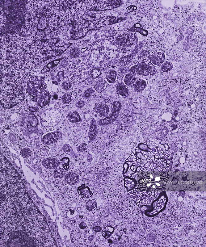 电子显微镜下的肺泡中被巨噬细胞吞噬的支原体细菌图片素材