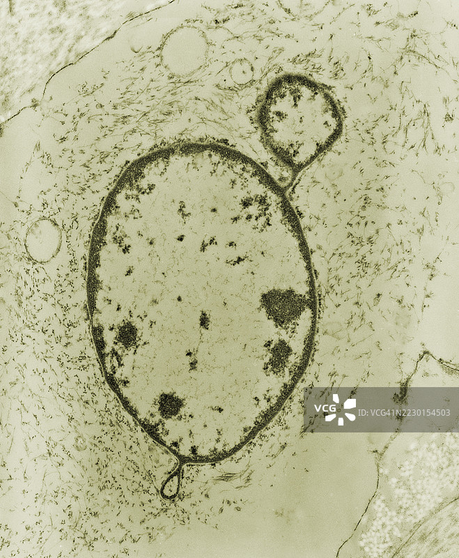 电子显微镜下显示胶原纤维融化，细胞核的一部分像气泡一样突出于单个细胞的微观细胞器之间。图片素材