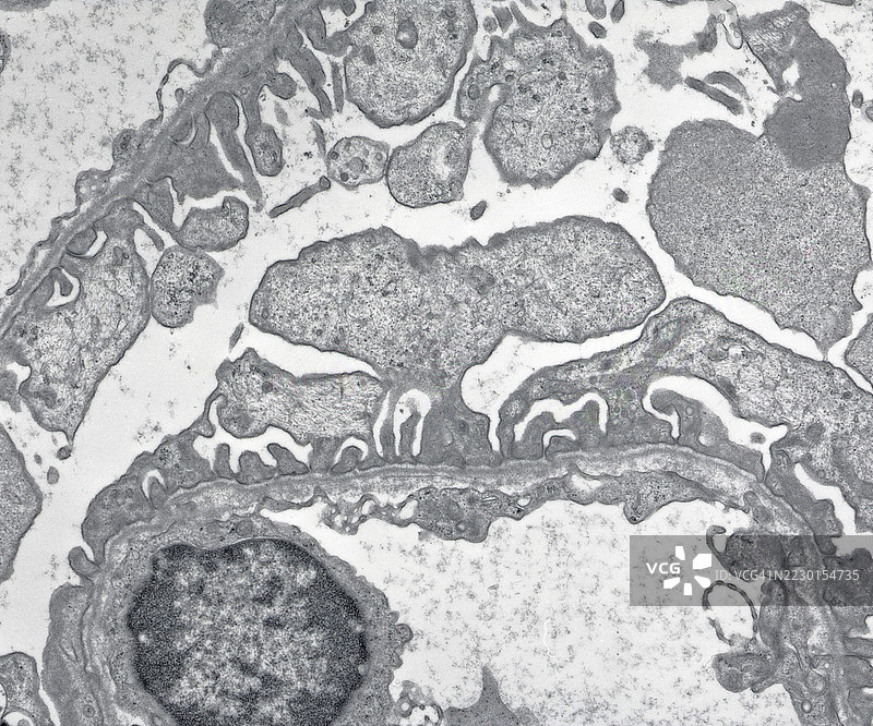 肾小球的电子显微镜图像图片素材