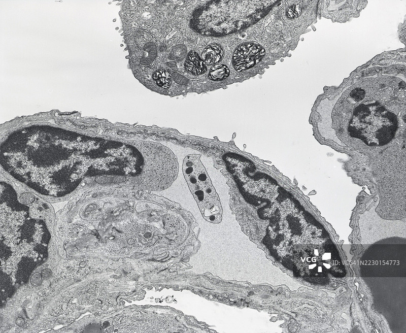 肺泡腔内发现的血小板、II型肺泡上皮细胞、基底膜和毛细血管内皮细胞的电子显微镜图像图片素材