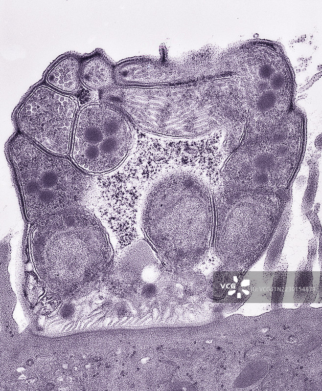 电子显微镜下的隐孢子虫感染结肠黏膜，增殖体，20,000倍放大图片素材