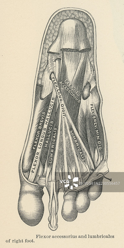 古老的雕刻插图，显示了方 plantar 肌（屈肌附加肌），被外侧 plantar 血管和神经与第一层肌肉分开。图片素材