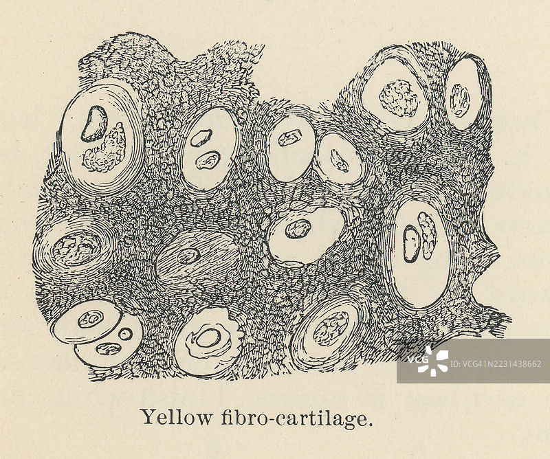 老式雕刻插图，展示了黄色纤维软骨、弹性软骨或黄色弹性软骨，含有密集的黄色弹性纤维网络和胶原纤维。图片素材