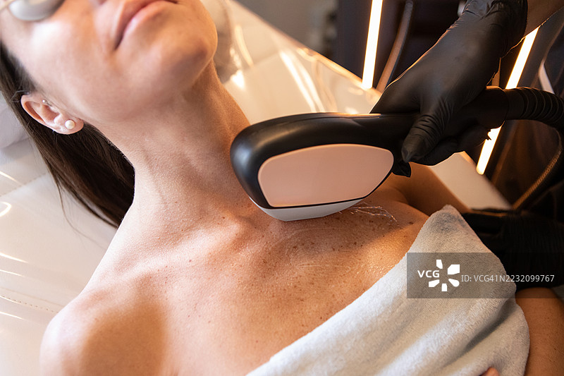 尖端激光去除皮肤瑕疵的应用图片素材