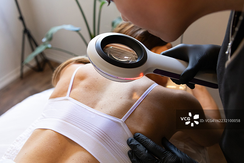 皮肤科医生正在用皮肤放大镜检查她患者的背部图片素材